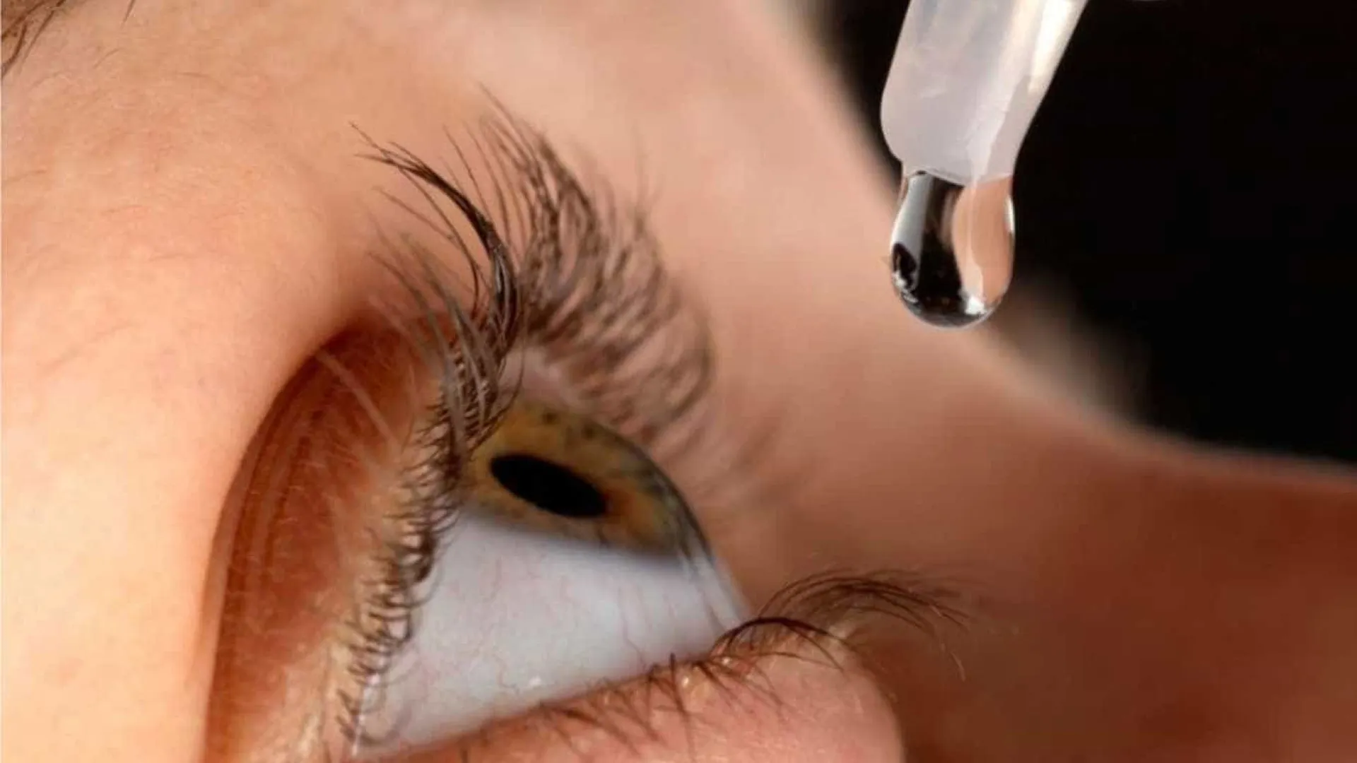 Compartilhar colírio pode levar a perda de visão