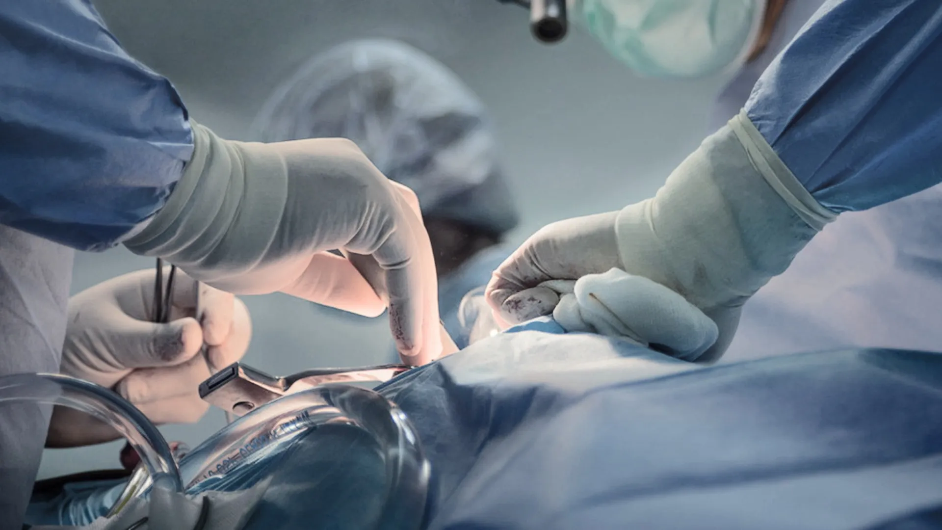 Vaticano autoriza xenotransplante para católicos