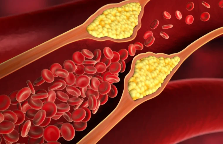 Alimentos baratos ajudam a reduzir níveis de colesterol