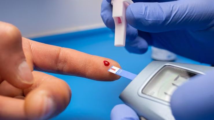 Bertioga promove exames laboratoriais neste sábado